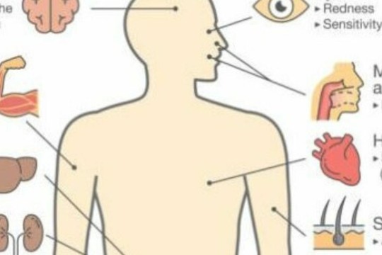 W. Equatoria State receives Yellow Fever vaccines