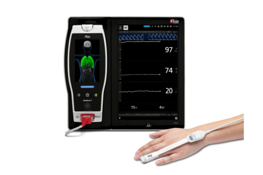 New Study Finds That Masimo PVi® Reliably Predicted Fluid Responsiveness in Young Children Undergoing Neurosurgery