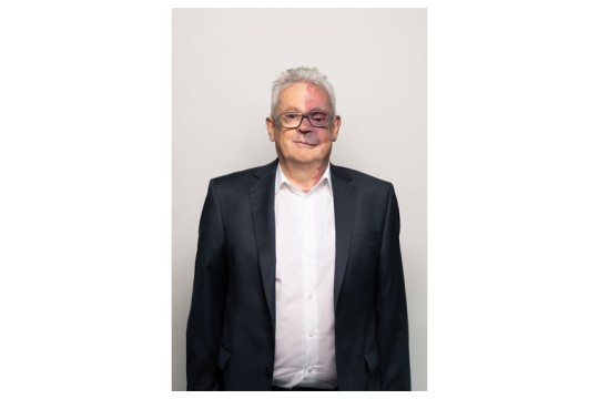 سرطان الدم: إعلان AOP Health نتائج جديدة تخص المرضى المصابين بمرض كثرة الكريات الحمراء الحقيقية، والتي نشرتها في المجلة الطبية Leukemia