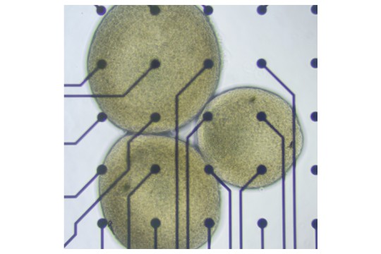 FinalSpark Launches the First Remote Research Platform Using Human Neurons for Biocomputing