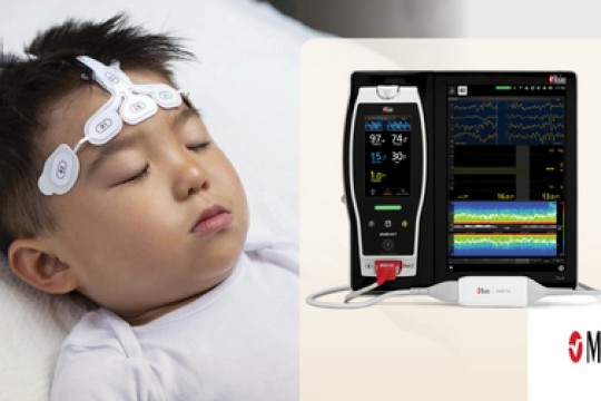 New Study Finds Masimo SedLine® Brain Function Monitoring Offers Significant Advantages During Pediatric Anesthesia