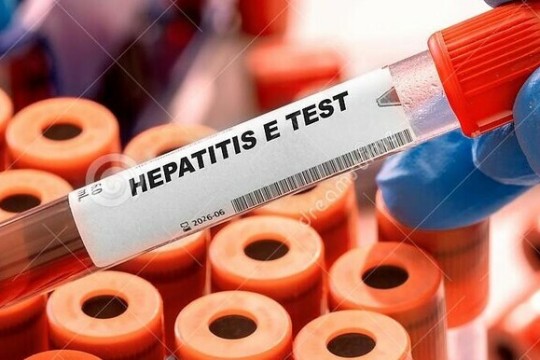Hepatitis E infections on the rise in Unity State