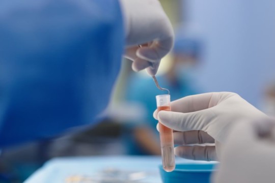 Abu Dhabi Stem Cells Centre pioneers testicular cryopreservation for four boys before bone marrow transplants